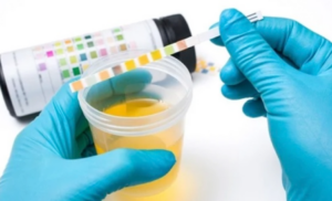 Gloved hands testing urine with dipstick