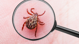 Tick on skin under magnifying glass